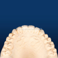 Advanced na Dental IPS Emax para sa Pagpapanumbalik